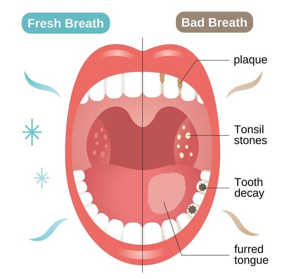 Monthscare™ Whitening Toothpaste
